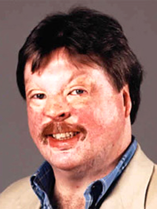 Simon Weston OBE